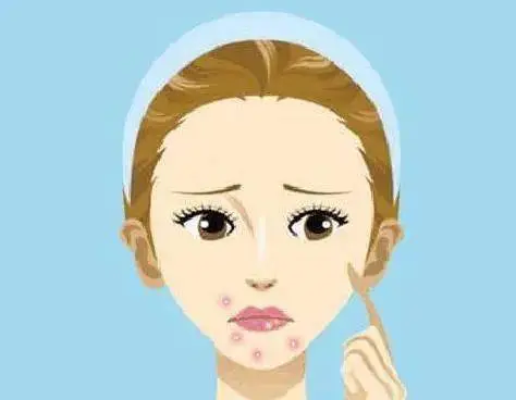 痘痘告诉你哪里生病了 长痘痘是身体哪里出了问题